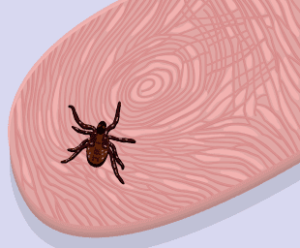 Bed bug, bed bug size